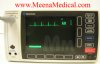 Space Lab ECG Monitor Model: 90604A